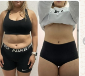 Comparativa de antes y después enviada por una clienta tras un mes de tratamiento.